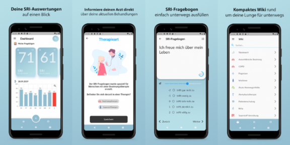 Grafik mit Ansichten aus der SRI-App